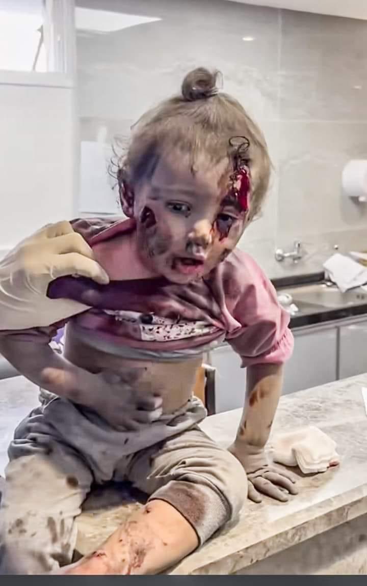 HosseinAsmaa's tweet photo. Children who fell asleep in the middle of the hospital were bombed!
#مستشفى_الشفاء #GazaHolocaust #Gaza_Geniocide #GazaCeasefire #Israel #IsraelTerorrist https://t.co/ByR2qfJVdB