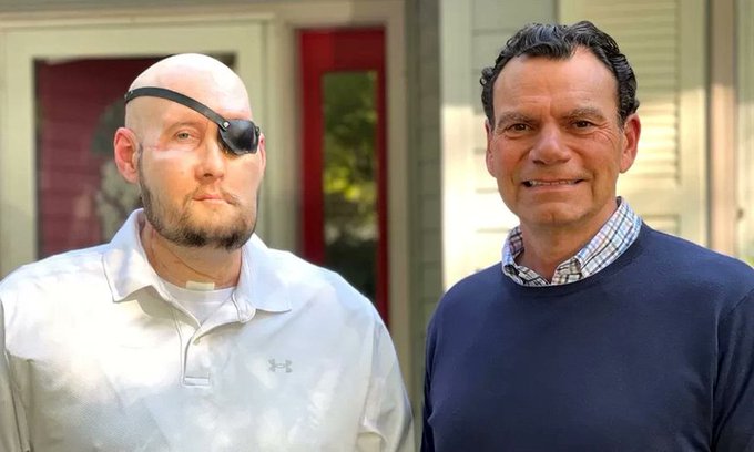 বিশ্বের প্রথম চক্ষু প্রতিস্থাপন যুক্তরাষ্ট্রে