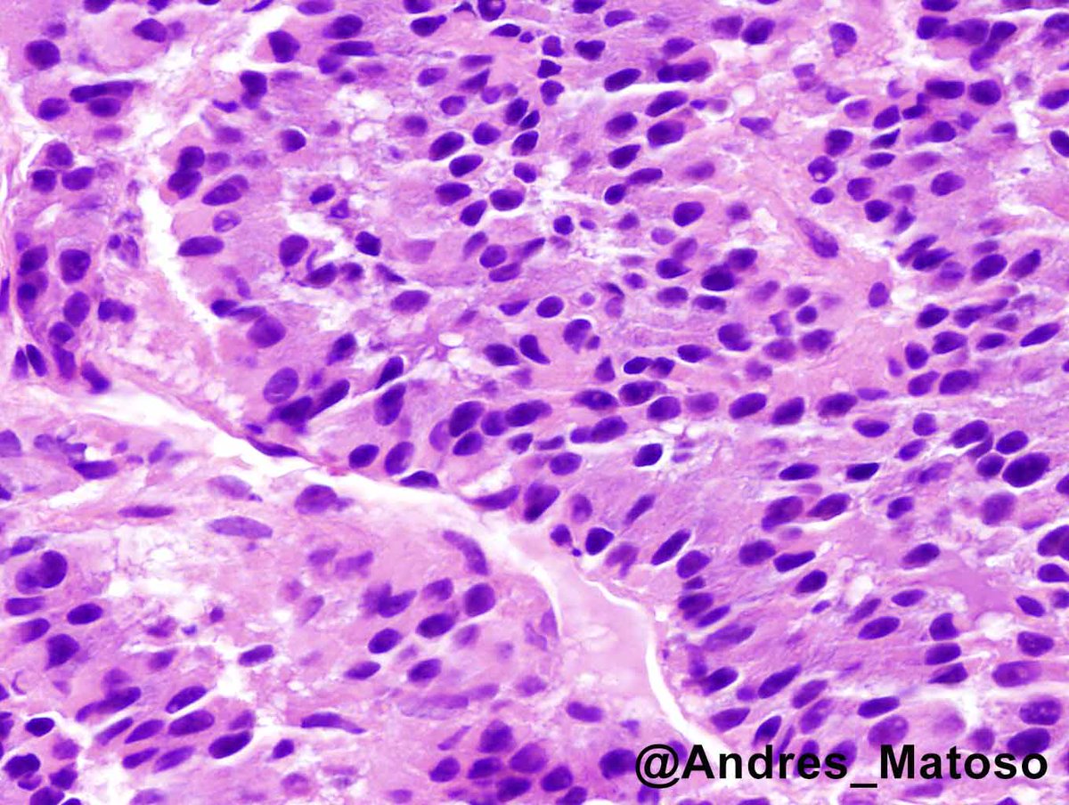 Andres Matoso tweet media