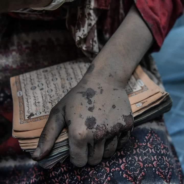 صورة الليله اوصلوها للعالم كله..واستفيدو من اهل غزه فوالله لن يخذل الله شعبا متوكلا عليه وواثقا بلطفه ونصره.
#غزة_تُباد #أبوعبيدة