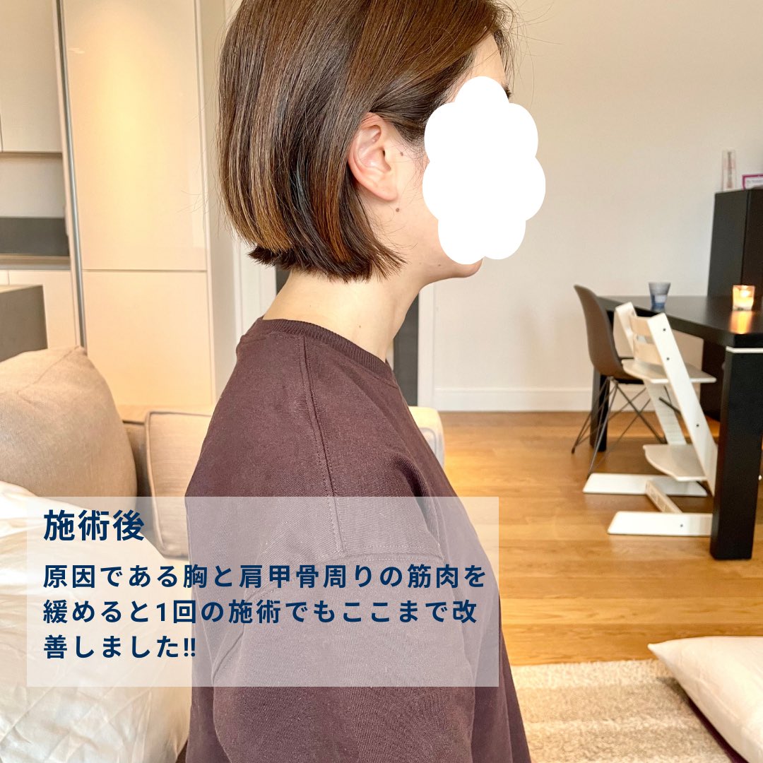 stretch0119's tweet photo. 【巻き肩やストレートネックを改善したい方へ‼️】 今まで諦めかけていた姿勢改善。ストレッチで改善できます。本気で改善したい方はこちらからご連絡ください💁‍♂️ https://t.co/bOgs4uZnHK

#ロンドンストレッチトレーナー https://t.co/wfCADwioF1