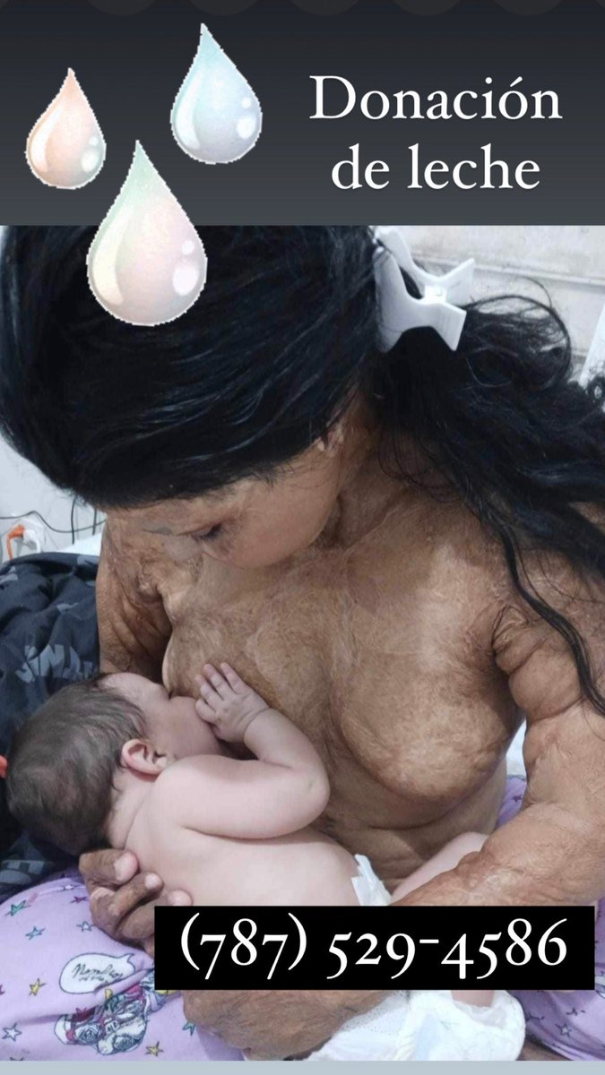 Recurro nuevamente a ustedes humildemente con el corazón en la mano para solicitar donaciones de leche humana para mi bebé de 7 meses.  Yo lacto por una teta, ya que por la otra no puedo por las quemaduras. 
Ojalá y logre conseguir varias donantes, ya que tengo leche para 2 días.