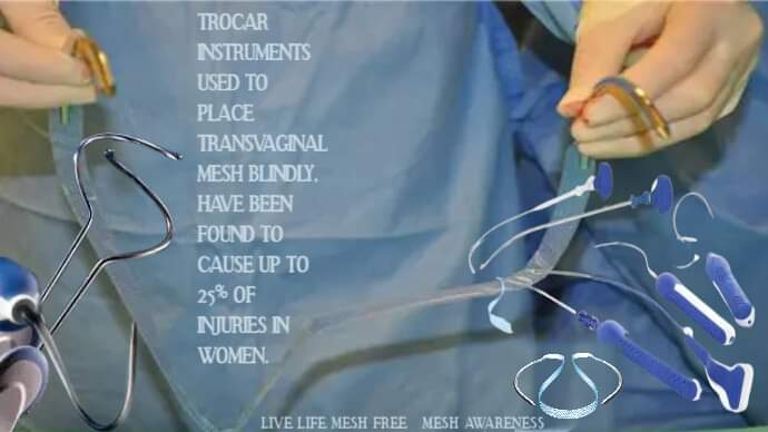 Barbaric! The early Trocar Instruments used to Blindly Implant TV Mesh in women were huge. Mesh Makers have kept changing the Mesh and Instruments up trying to find the perfect Mesh. My experience in 2011 was that it HURT like Hell. The pain has never gone away! #MeshHell