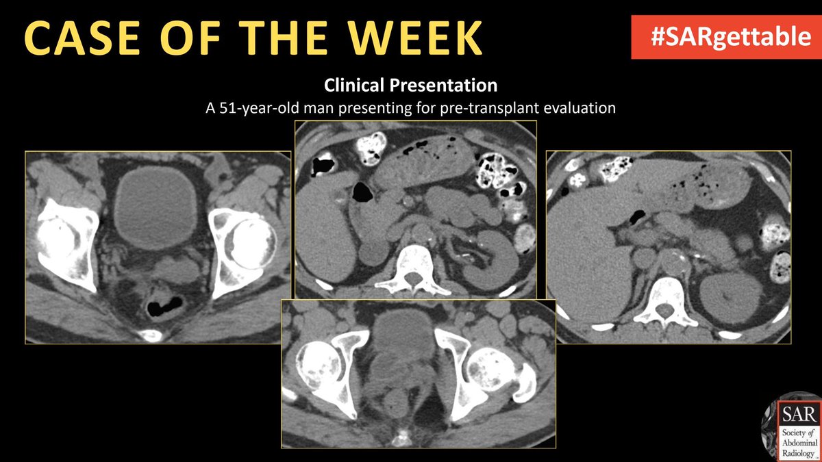 It's time for a new #SARgettable case of the week contributed by @ItaniMalak and @MIRimaging! Comment with your diagnosis down below!