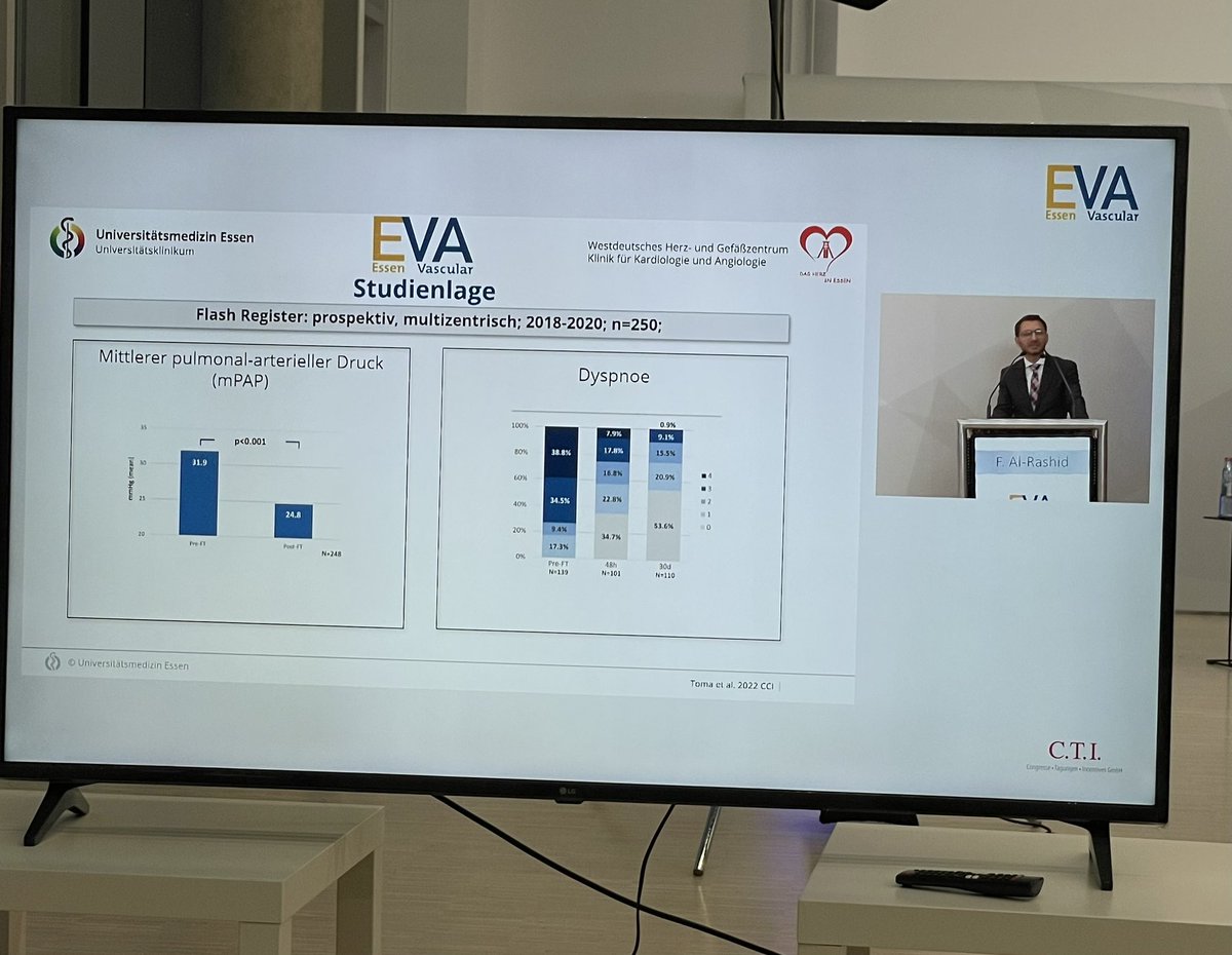 Daniel Messiha, MD (@realdocdan) on Twitter photo #EssenVascular2023. <a href="/alrashidfadi/">Fadi Al-Rashid</a> über die interventionelle Behandlungsstrategie der LAE.
🔹Post-LAE Einschränkungen relevant
🔹Interventionelle Therapie auf dem Vormarsch - PERT Team essentiell
🔹Sofortige Symptombesserung und Reduktion der PA-Drücke durch Thrombusaspiration #EssenVascular2023. <a href="/alrashidfadi/">Fadi Al-Rashid</a> über die interventionelle Behandlungsstrategie der LAE.
🔹Post-LAE Einschränkungen relevant
🔹Interventionelle Therapie auf dem Vormarsch - PERT Team essentiell
🔹Sofortige Symptombesserung und Reduktion der PA-Drücke durch Thrombusaspiration