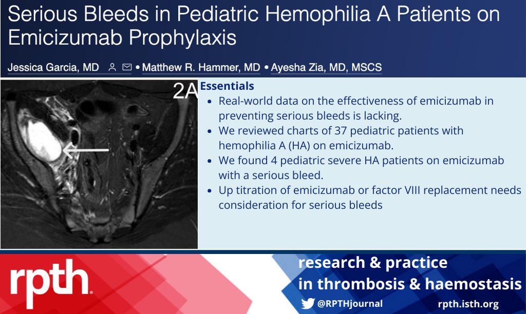 RPTHjournal's tweet photo. In this #RPTH brief report @DrJessGarcia @HammerRadiology @AyeshaNZia report real-🌎 data on the effectiveness of Emicizumab in pediatric #hemophilia A patients. 
Read here ➡️: https://t.co/ZdZRdFhkzu https://t.co/xYUHz3a1AI