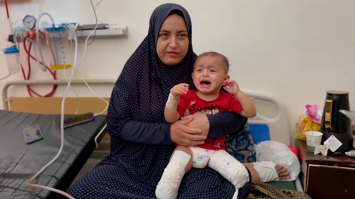Two-year-old Fatima's legs were crushed under the rubble of her home. "Her life revolves around painkillers" her mother says. With freelance journalists in Gaza we report on the children ravaged by war bbc.com/news/world-673…