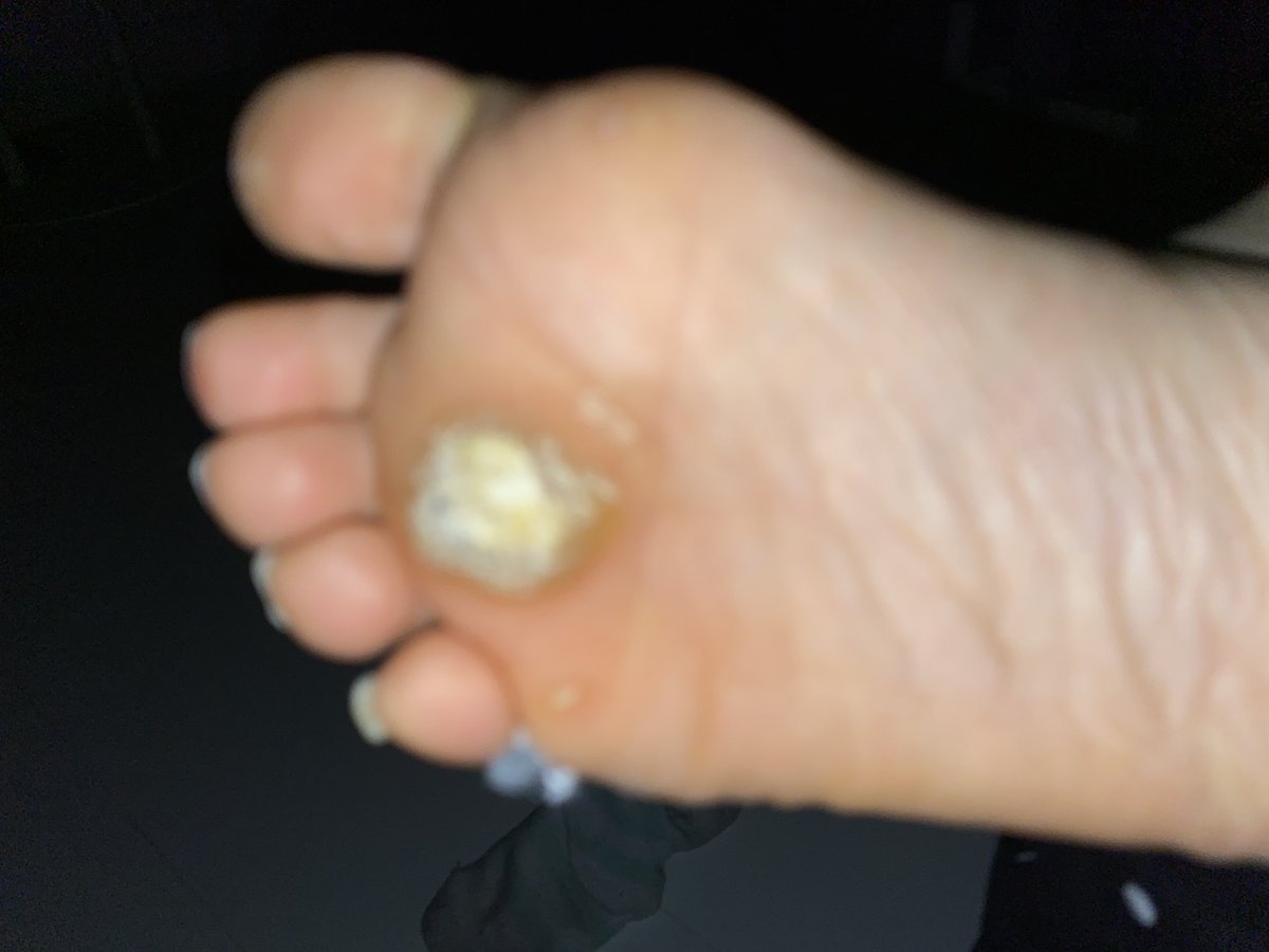 DBBfeet's tweet photo. For clear pictures of my feet click the link on my bio 🦶✨
#feetfinder #dirtyfeet #feetpicsforsales https://t.co/9oxdDm9JnS