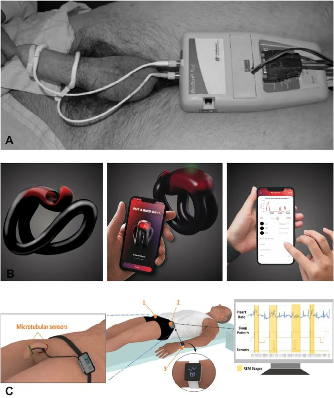 IJIR: Your Sexual Medicine Journal (@yoursexmedjour) on Twitter photo Nocturnal penile tumescence devices: past, present and future 👉 rdcu.be/dqM8P
<a href="/md_schardein/">Jessica N. Schardein, MD (she/her)</a> <a href="/KelliGrossMD/">Kelli Gross, MD</a> <a href="/UtahUrology/">University of Utah Urology</a> Nocturnal penile tumescence devices: past, present and future 👉 rdcu.be/dqM8P
<a href="/md_schardein/">Jessica N. Schardein, MD (she/her)</a> <a href="/KelliGrossMD/">Kelli Gross, MD</a> <a href="/UtahUrology/">University of Utah Urology</a>