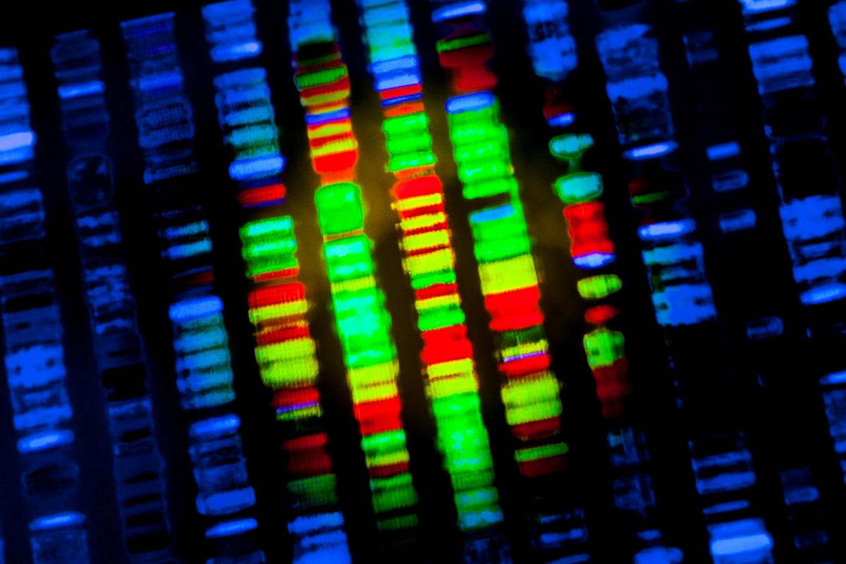 SickKidsNews's tweet image. The Pan-Canadian Genome Library (#PCGL)🧬, led at #SKResearch by Dr. Stephen Scherer &amp;amp; Dr. Lisa Strug, aims to unify human #genome sequencing in Canada, reflect 🇨🇦&apos;s genomic diversity &amp;amp; fuel future health studies.

Read ➡️ bit.ly/49tjTaF