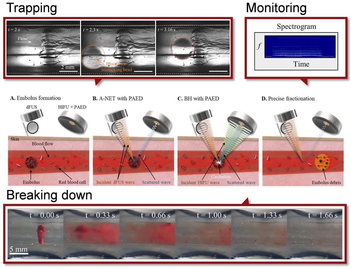 Thank you @junhong_park29 for presenting at the RSL: For effective blood clot treatment, a novel sonothrombolysis method is suggested, using ultrasound to catch, break down, and monitor the clots. Link to publication: doi.org/10.1016/j.ults…