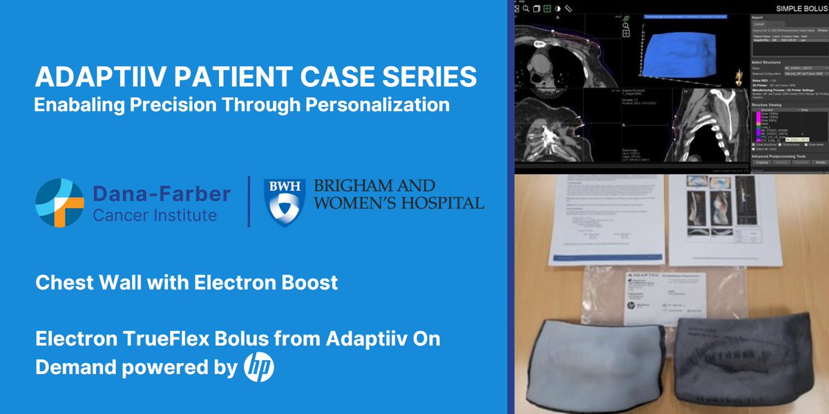Adaptiiv Medical Technologies Inc. (@adaptiivco) on Twitter photo Our latest installment in the Adaptiiv patient case series, <a href="/DanaFarber/">Dana-Farber</a> used Adaptiiv On Demand for a chest wall boost case. Special thanks to Laura Warren for providing valuable insights and this compelling case study. #3dprinting #radiationtherapy adaptiiv.com/resource/dana-… Our latest installment in the Adaptiiv patient case series, <a href="/DanaFarber/">Dana-Farber</a> used Adaptiiv On Demand for a chest wall boost case. Special thanks to Laura Warren for providing valuable insights and this compelling case study. #3dprinting #radiationtherapy adaptiiv.com/resource/dana-…