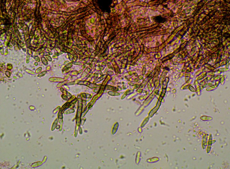 Decided to record the lichens and #lichenicolous fungi on wind-dropped twigs and small branches from a mature Dorset roadside Oak. So far 42 species including 15 LF's and Licea parasitica (lichenicolous myxomycete) - and finally found Gonatophragmium lichenophilum! <a href="/obfuscans3/">Mark Powell</a>