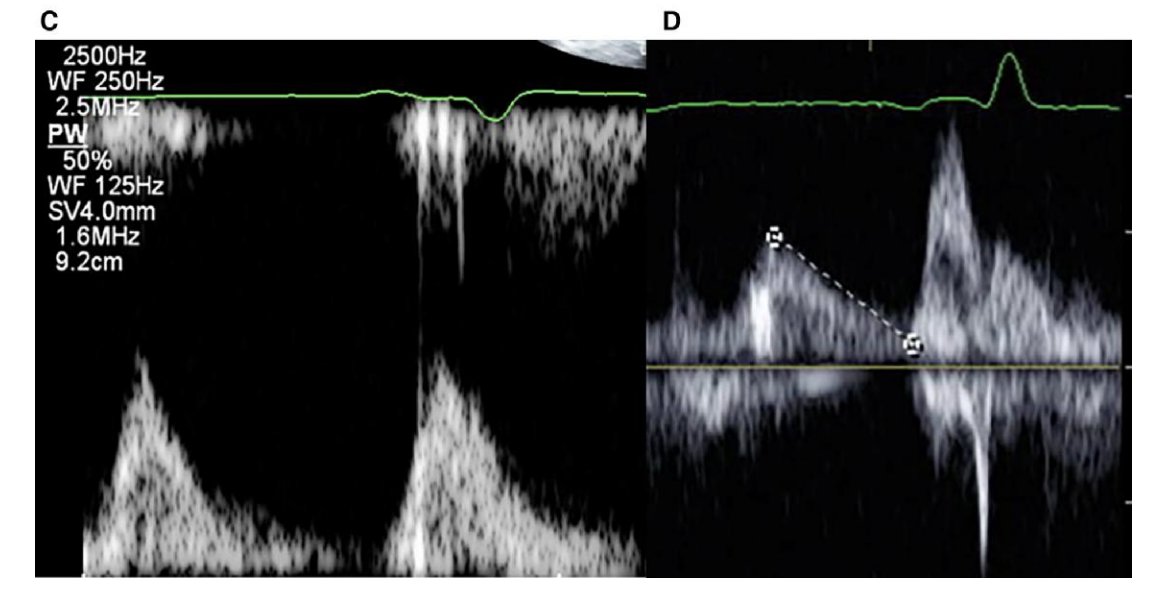 Natasha Vedage, MD MSCE tweet media