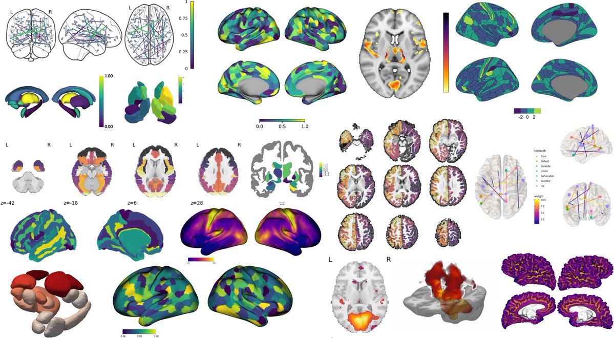 Dr_Alex_Crimi's tweet image. #dataviz A Practical Guide for Generating Reproducible and Programmatic #Neuroimaging #Visualizations in #Python #Matlab and #R 
👇👇👇

apertureneuro.org/article/85104-… by .
@SidChop @AvramHolmes
 et al.   @ApertureOHBM
  #brain #openscience #reproucibility