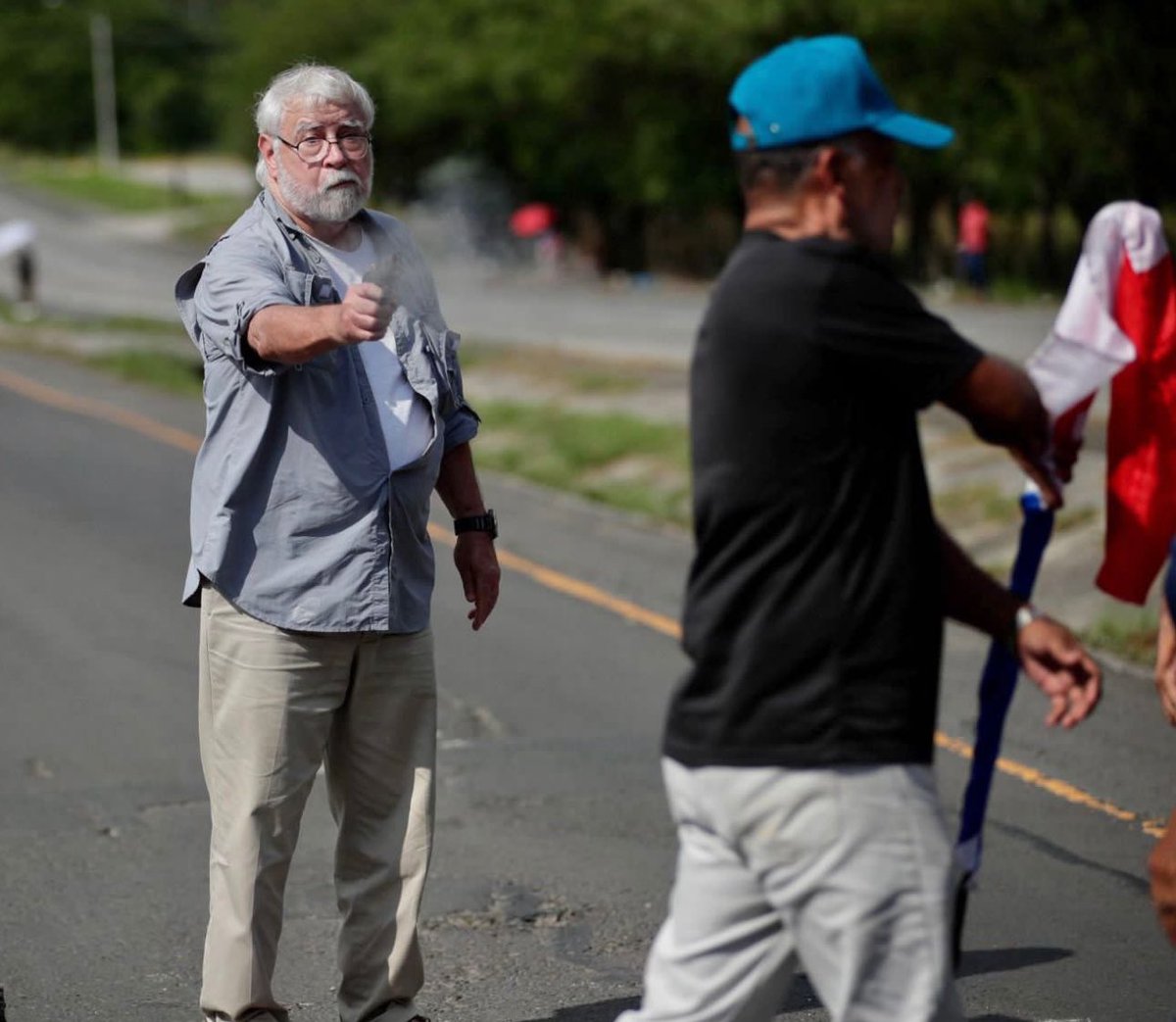 Pierden el ojo hermanos que luchan por el pais. 
Asesinan a dos compatriotas luchando por el pais. 
El Asesino le estan llamando "heroe",  en ciertos medios globales y gente de BASTANTE PESO y seguidores. 

Y nuestros artistas mas grandes de musica urbana latina que 100% se deben