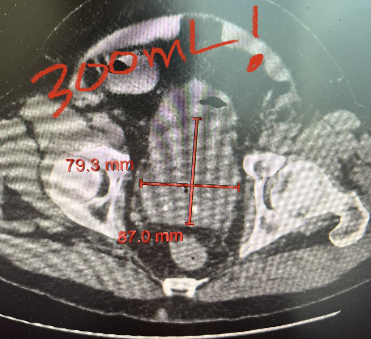 Mark Assmus tweet media