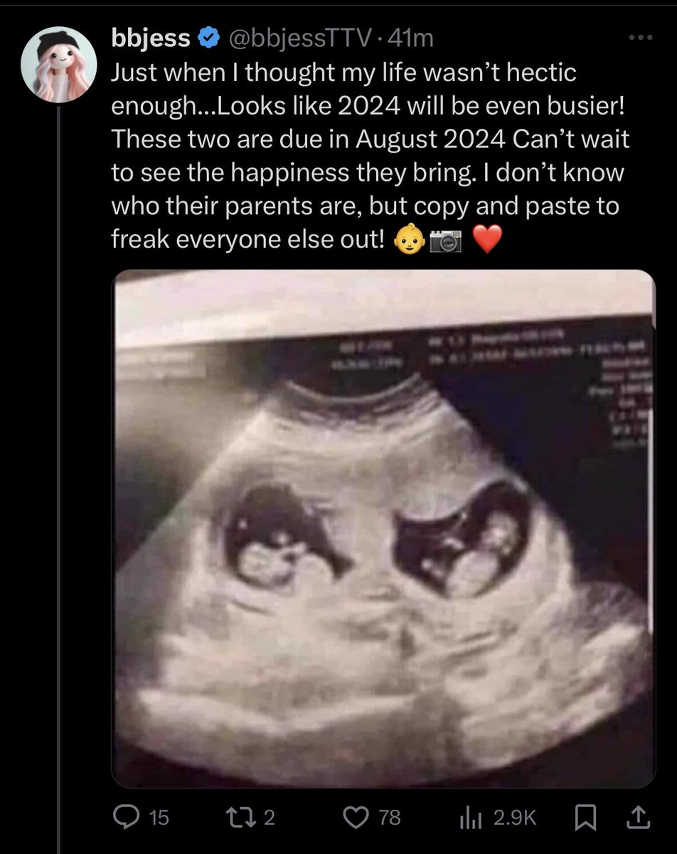 heyycasstv's tweet photo. Hi, fake pregnancy announcements are vile. Just a reminder. https://t.co/oKEKr5lINl