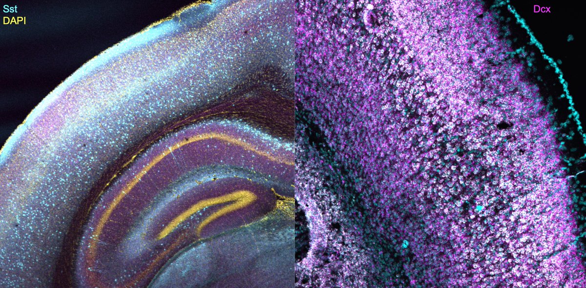 Ivan Alex Lazarte y Priela (@ivanalexlazarte) on Twitter photo I will be presenting our work at the <a href="/Interneuron_Dev/">Butt Lab - Oxford</a> lab on how GABAergic interneurons develop in cortical circuits, both in vivo and ex vivo, in early postnatal life in mice. We found that SST+ interneurons form different circuits early in development between S1 and V1. #SfN23 I will be presenting our work at the <a href="/Interneuron_Dev/">Butt Lab - Oxford</a> lab on how GABAergic interneurons develop in cortical circuits, both in vivo and ex vivo, in early postnatal life in mice. We found that SST+ interneurons form different circuits early in development between S1 and V1. #SfN23