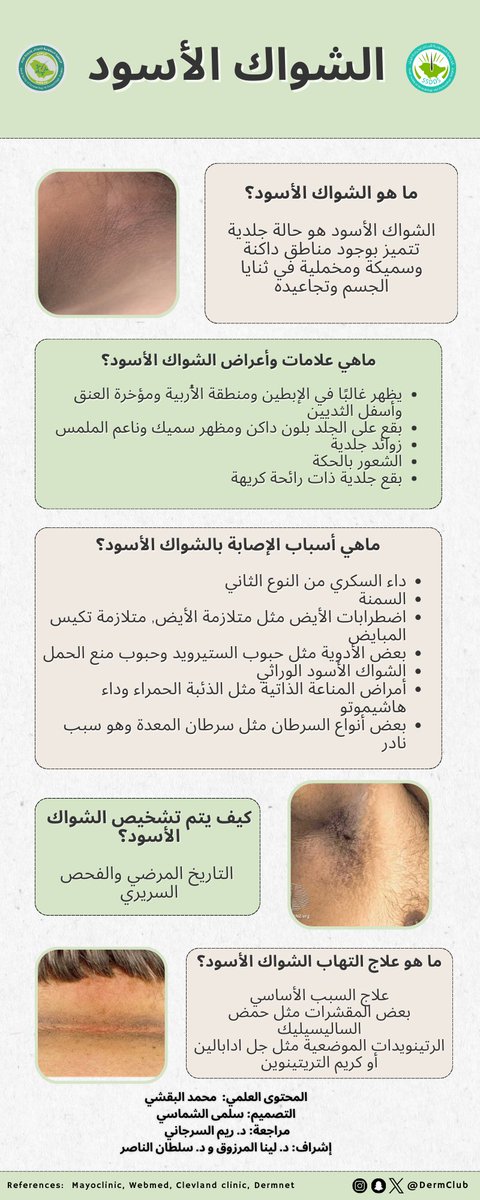 DermClub's tweet photo. تعرّف أكثر على الشواك الأسود https://t.co/RoKnq2vdYL