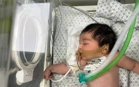 SoftWarNews's tweet photo. Baru saja diumumkan (1 menit yang lalu), 39 bayi di inkubator Rumah Sakit Al-Shifa Gaza meninggal dunia karena tidak ada listrik.

Israel dan Barat berbohong tentang 40 bayi Israel yang dipenggal untuk membenarkan genosida di Gaza.

#IsraelisaGenocidalState #GazaHolocaust https://t.co/XBC9WyEUIq