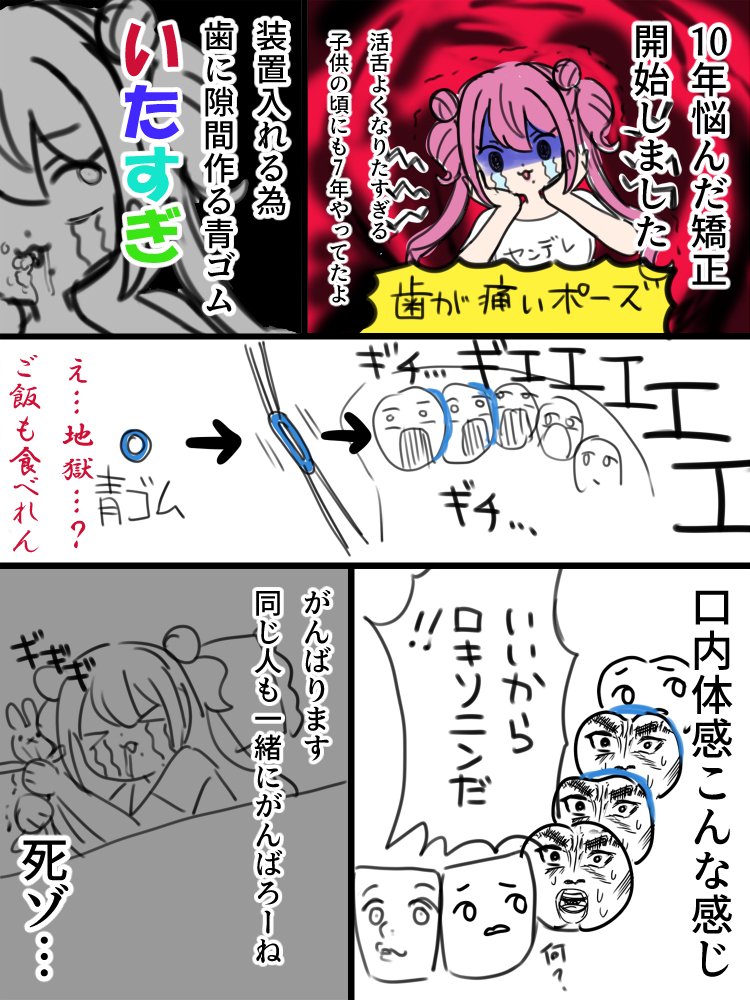 日記です 歯科矯正はじめました!痛すぎてしんでる 死の青ゴムが初手ラスボスすぎる 滑舌よくなる為&綺麗になる為がんばるぞ～!
