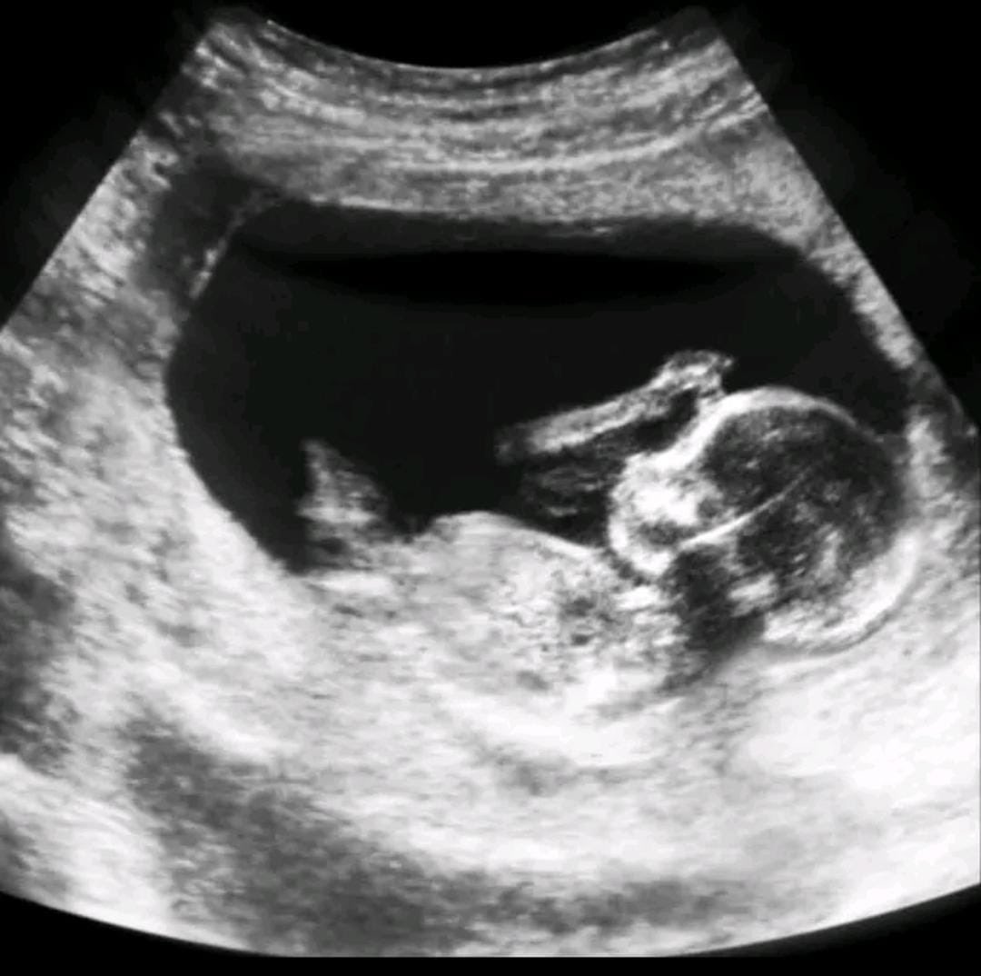 kingghelly's tweet image. 🤍