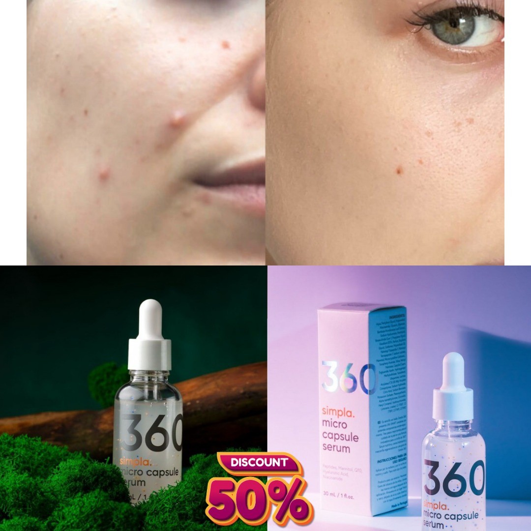 The Simpla serum is worth having the name of a new skin care superhero.
Get 50% Discount On Simpla306 Any Pack ..so order. Check the link in my bio  now#simpla360 #germany #deutchland #healthcare #Simpla360 #simplaodetudo #serumConVitaminC #retinol #simpla