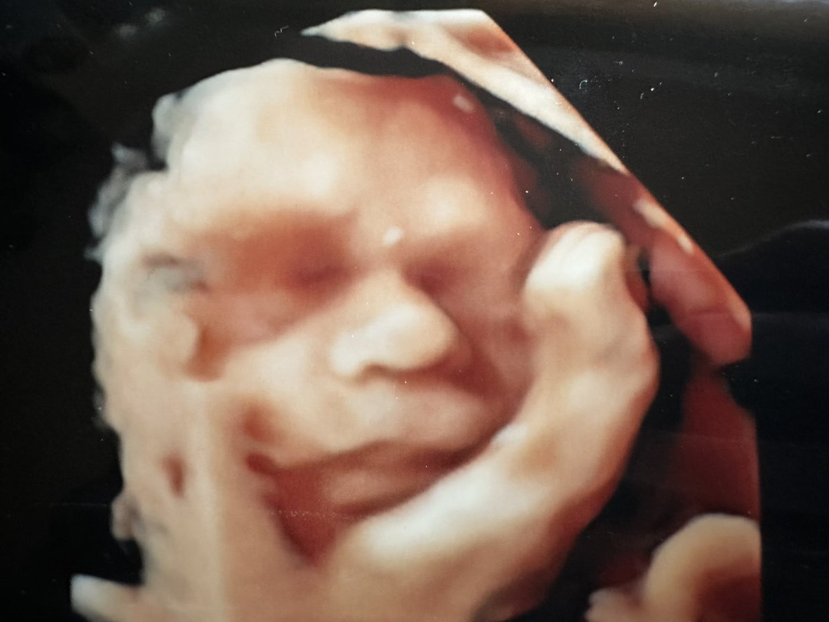 Suzy7131's tweet photo. 2 months left before we finally get to meet you #thirdtrimester #2months #soonbeparents https://t.co/7KYUcBOBku