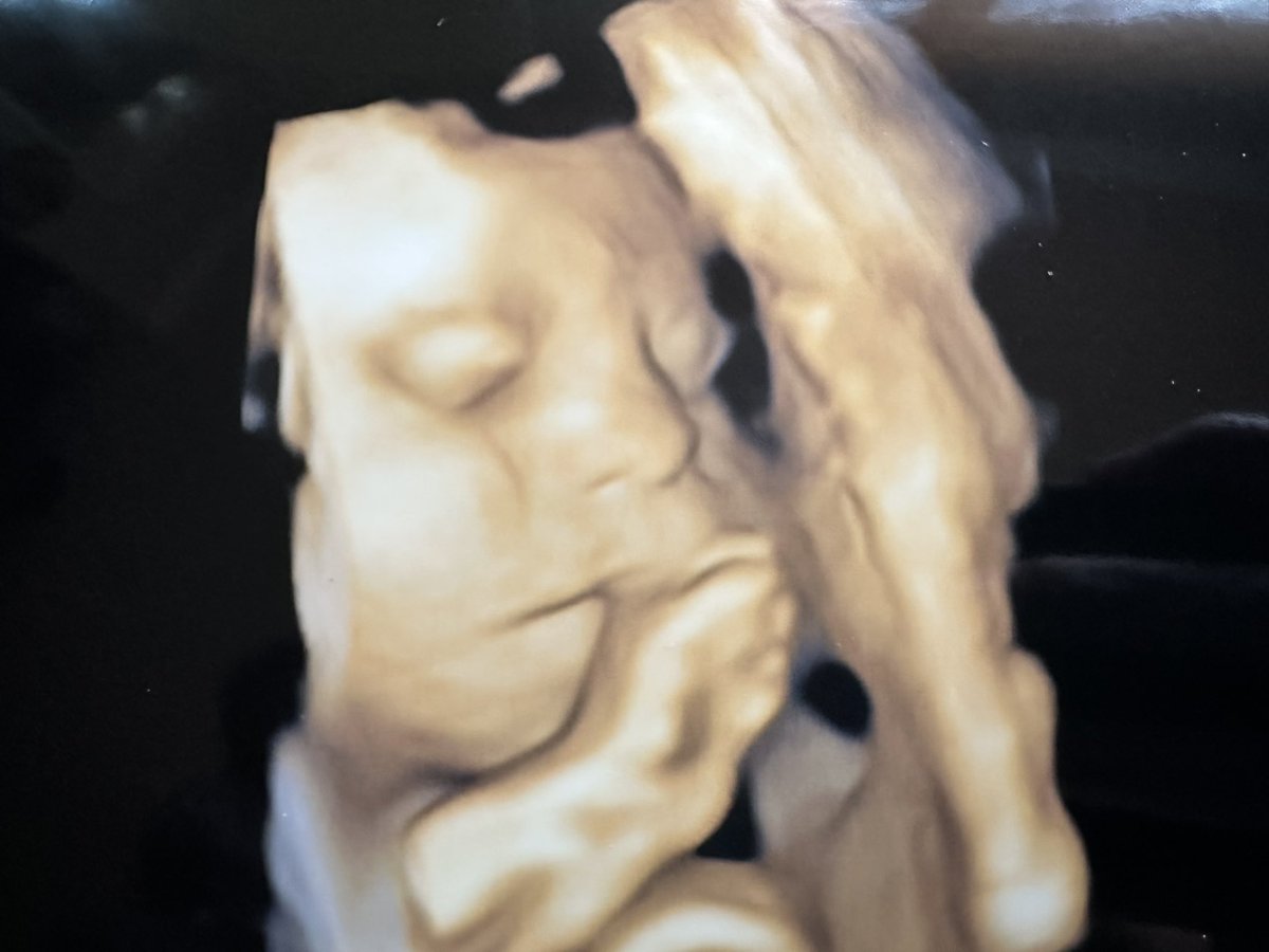 Suzy7131's tweet photo. 2 months left before we finally get to meet you #thirdtrimester #2months #soonbeparents https://t.co/7KYUcBOBku