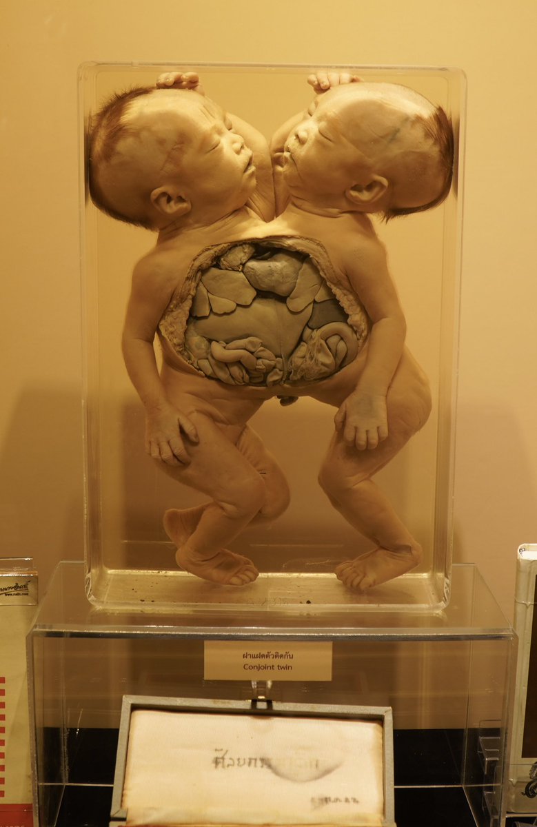 閲覧注意】今日は呪物市場に行って、胎児のミイラ化したお守り