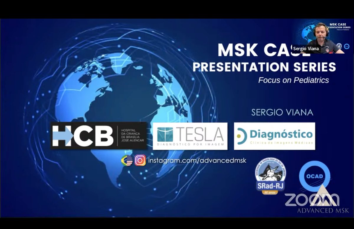 🇧🇷A sessão de discussão de casos de imagem musculoesquelética pediátrica de outubro da "OCAD Case Presentation Series", com a participação do Dr. Sergio Lopes Viana, já está disponível online no link bit.ly/ocadoct23. Não percam!