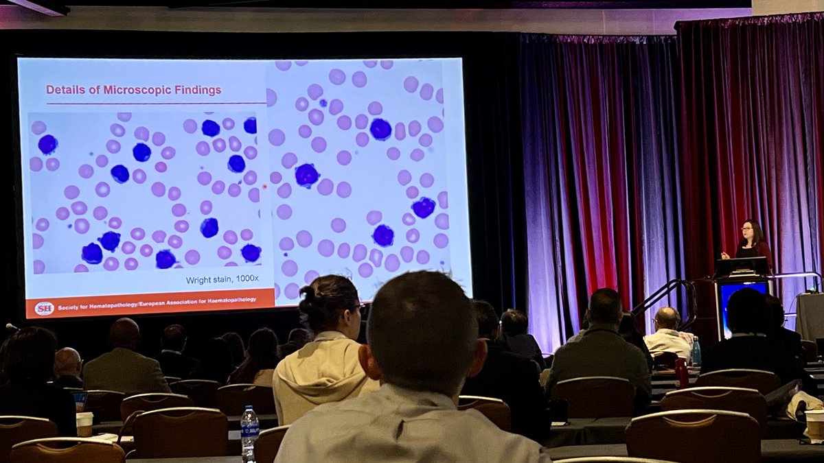 Our #hemepath fellowship PD and hematopathologist extraordinaire presents a case of TCL1 family negative T-PLL. #SH2023 #PathTwitter