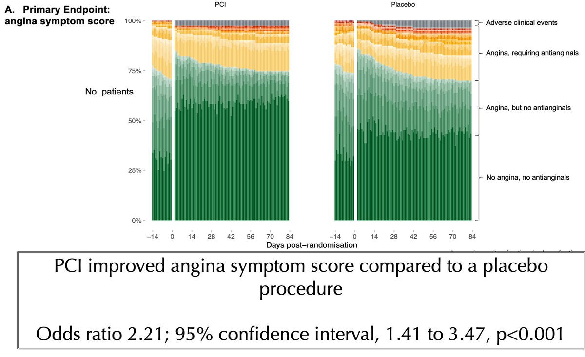 ORBITA-2
⁉️PCI vs placebo in stable CAD w/no-little antianginal meds
🌎 301 pts, 12 weeks FU
🎯 PCI improved angina score+frequency (assessed daily by app 📱), exercise time, CCS and QoL
💔 NO difference in antianginal medications, but still high residual symptoms
#AHA23 <a href="/NEJM/">NEJM</a>