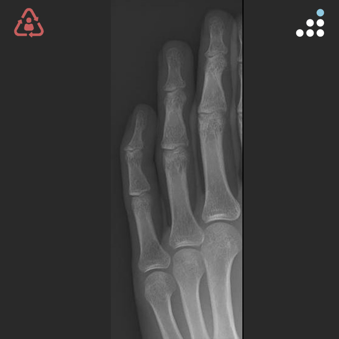 Orthobullets tweet media