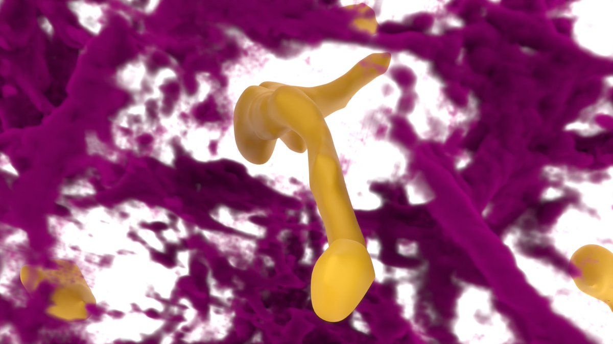 This is a microscopy image rendered on blender using the tif to blender add-on by <a href="/GrosOane/">Oane Gros</a>.
Their yt tutorial is very well done, it's really easy to get amazing images.