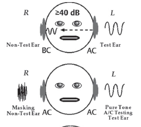 Audiologists: oh noes, our enrollment is down, we gotta attract more students Also audiologists: let's show this figure in class