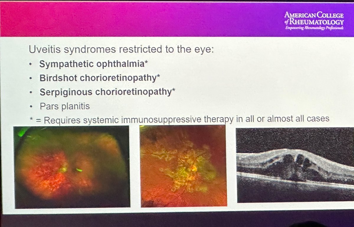 💡Location of inflammatory eye disease narrows differential.
💡Checkpoint inhibitors can cause anterior uveitis.
💡Systemic therapies are required in uveitis syndromes restricted to the eye.
💡Evidence of tocilizumab/RTX for refractory uveitis.
#ACR23 #Reviewcourse