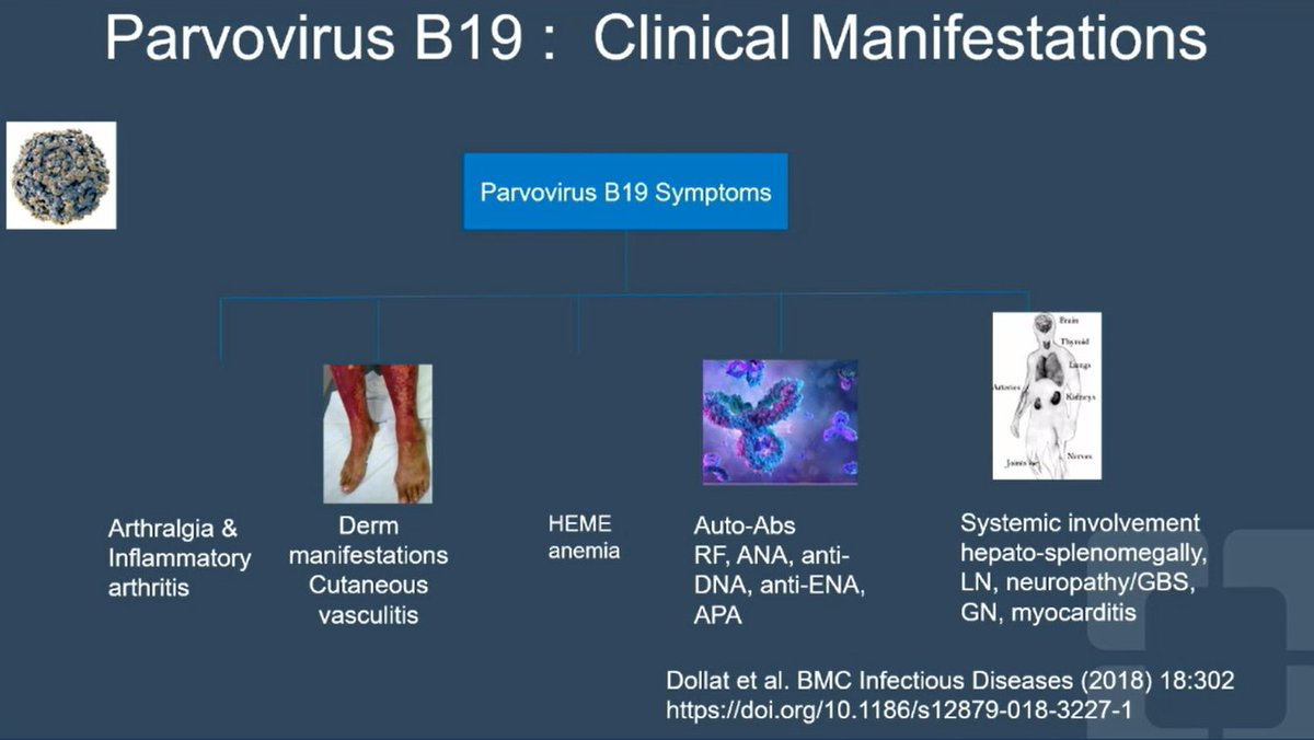 To finish the #ACR23 Review Course, one of my favourites: the erudite @LCalabreseDO on the complicated web between viral infections and autoimmunity. Complex interactions both ways. Isn't the immune system amazing? (& ref the @CleClinicMD service led by @CCalabreseDO) @RheumNow