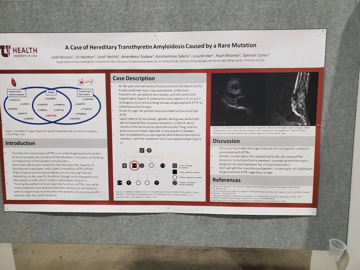 Spencer Carter (@spencercarter55) on Twitter photo Why do genetic testing in older patients diagnosed with ttr amyloid? Great case report by <a href="/UtahIMCMRs/">Utah IM CMRs</a> Leah Stinson outlining the effect of testing and cascade screening allowing for earlier dx and treatment of family members. <a href="/UofUHealth/">University of Utah Health</a> <a href="/UofUInternalMed/">University of Utah Department of Internal Medicine</a> Why do genetic testing in older patients diagnosed with ttr amyloid? Great case report by <a href="/UtahIMCMRs/">Utah IM CMRs</a> Leah Stinson outlining the effect of testing and cascade screening allowing for earlier dx and treatment of family members. <a href="/UofUHealth/">University of Utah Health</a> <a href="/UofUInternalMed/">University of Utah Department of Internal Medicine</a>