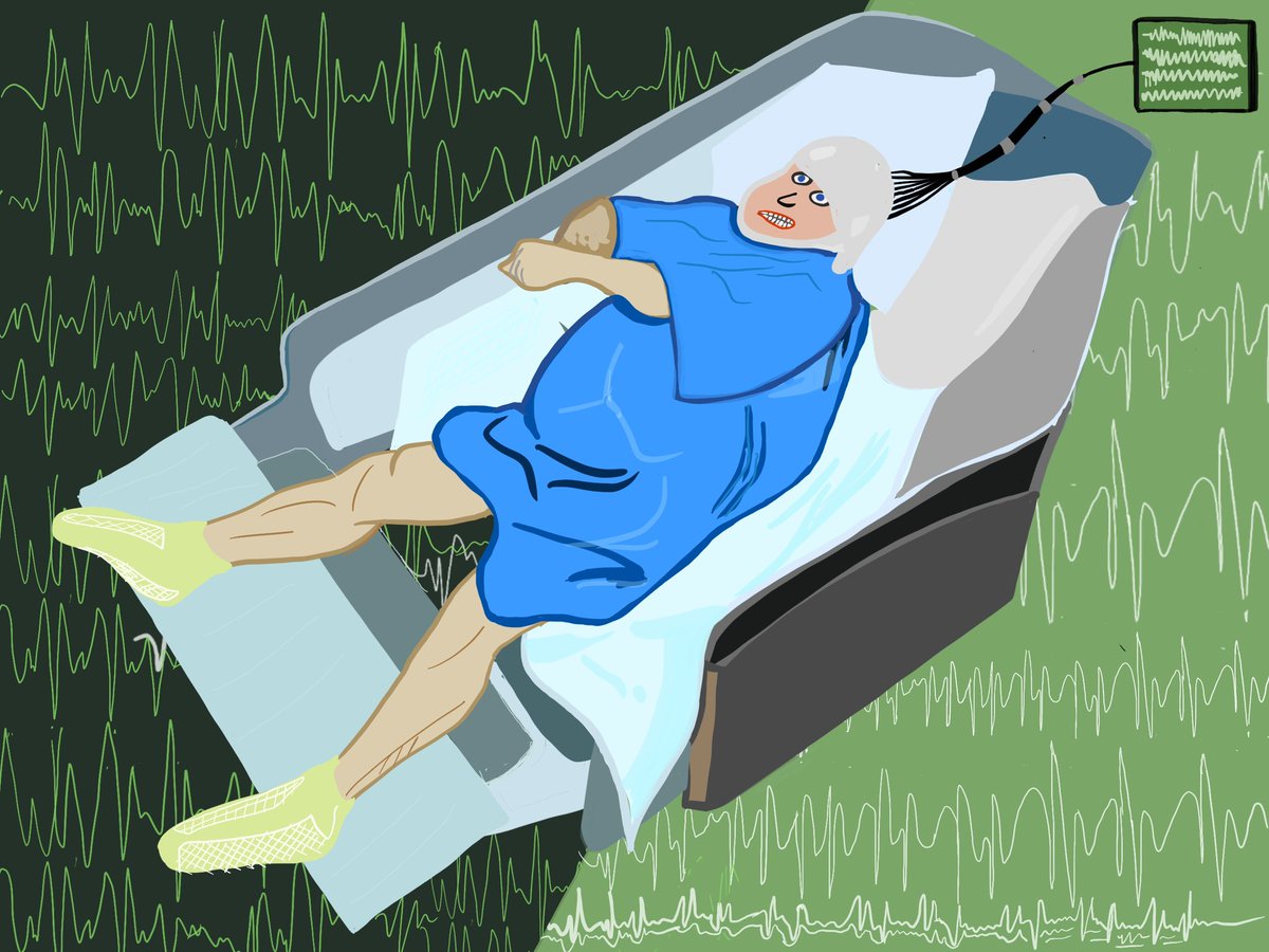 SarmaLab (@labsarma) on Twitter photo At Sarma Lab we are developing tools to diagnose and treat epilepsy and other neurological disorders.
This drawing is by <a href="/neuro_amir/">Amir Daraie</a>, who is currently working on developing a full pipeline for automated seizure detection and analysis that can be implemented in clinics. At Sarma Lab we are developing tools to diagnose and treat epilepsy and other neurological disorders.
This drawing is by <a href="/neuro_amir/">Amir Daraie</a>, who is currently working on developing a full pipeline for automated seizure detection and analysis that can be implemented in clinics.