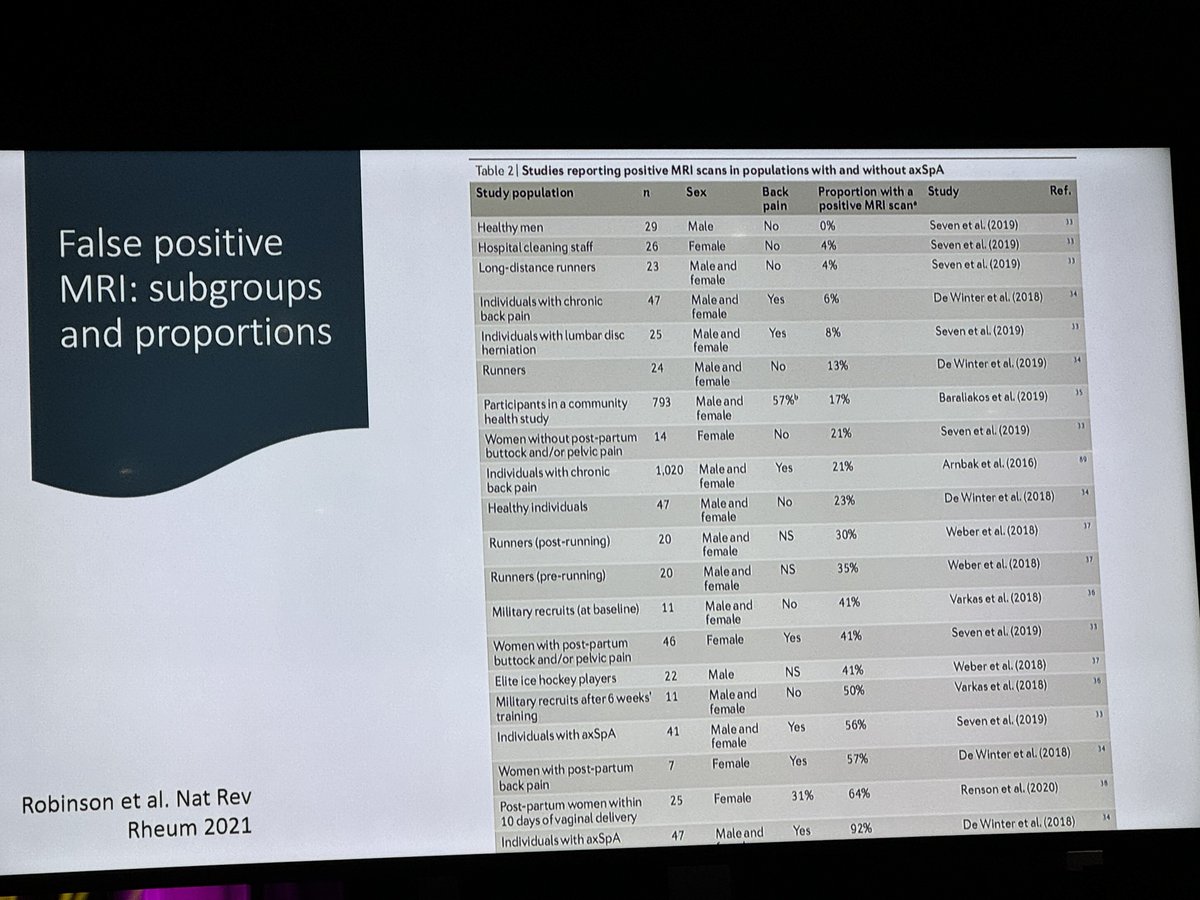 Takeaways from #ACR23 #ReviewCourse session on SpA Update: Radiographic and Non-Radiographic AS - Dr. Alexis Ogdie

1. Workup of inflammatory back pain: History, exam, CRP, HLA-B27, SI joint films, MRI pelvis (STIR images, no need for contrast). Response to NSAIDs not actually…