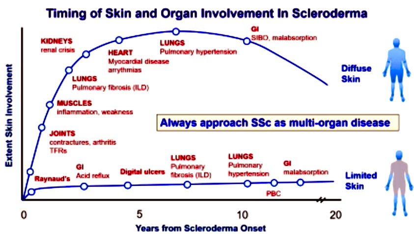 #Sclerodrema and organ involvement 

🚨always screen closely for organ involvement 

#ACR23 Review course 
#SystemicSclerosis #PAH