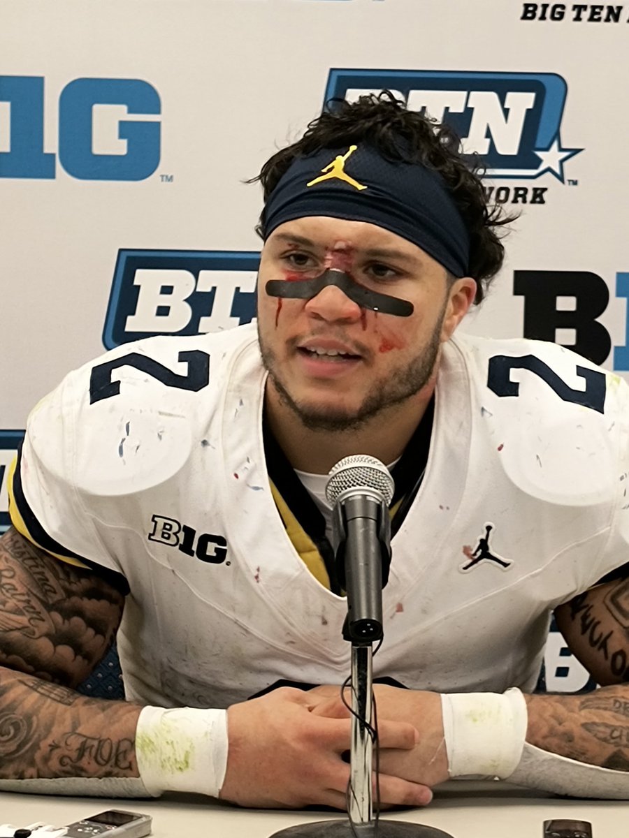 Rhyno54's tweet photo. You should see the other guys... trust me. #GoBlue #Manball https://t.co/uxnrXdLB9x