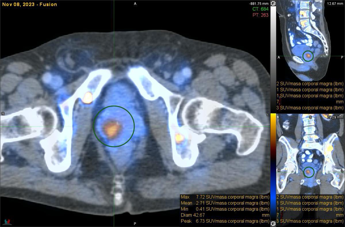 UroTeragLATAM tweet media