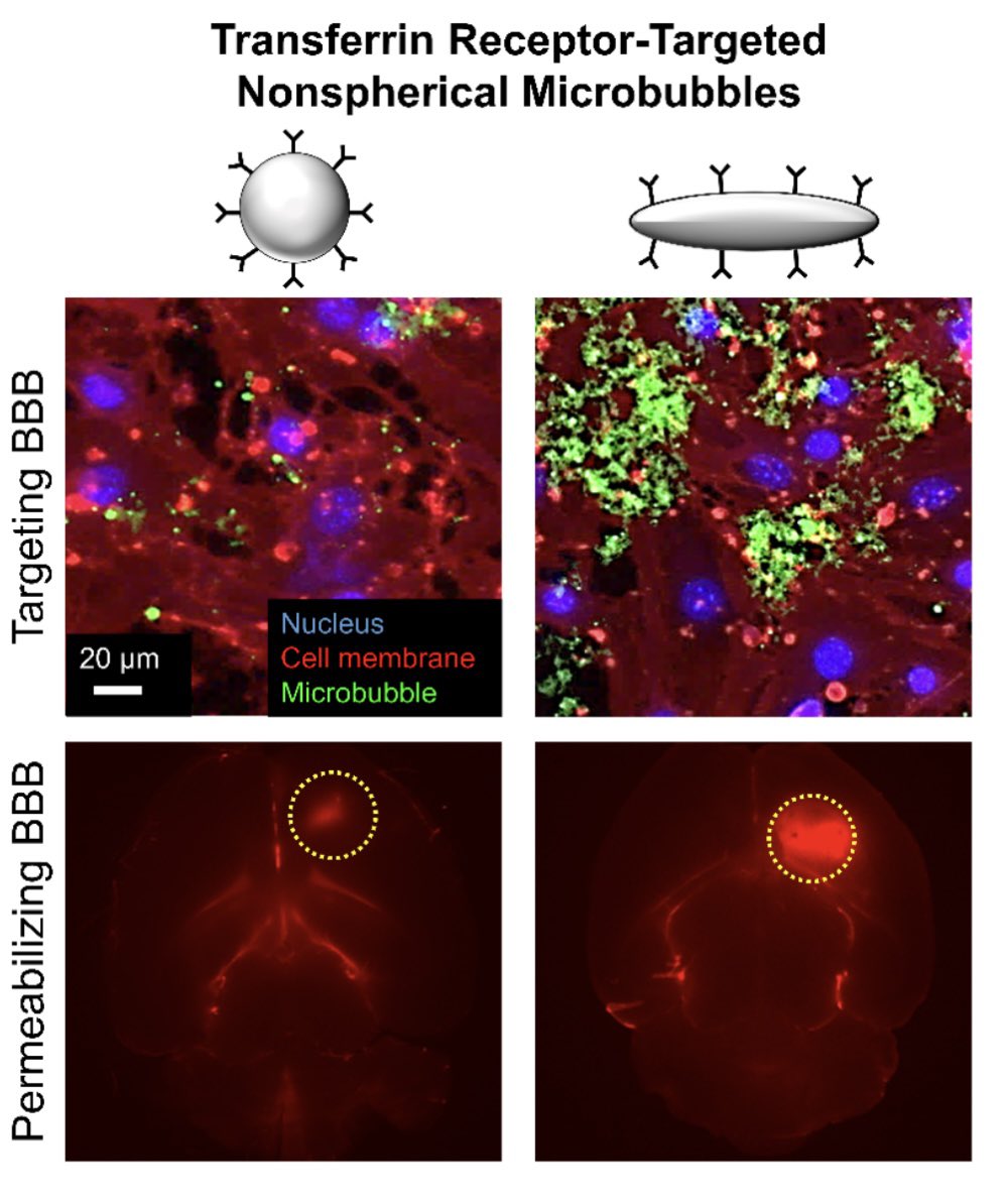 Pleased to see this out. Great work by <a href="/Anshu_Dasgupta/">Anshuman Dasgupta</a> on active targeting of shape-optimized microbubbles to brain endothelium. Many thanks <a href="/SMitragotri/">Samir Mitragotri</a> for co-leading this and all others for support🙏

doi.org/10.1002/adma.2…

#RTG2375 <a href="/UniklinikAachen/">Uniklinik RWTH AC</a> <a href="/RWTH/">RWTH Aachen</a>  <a href="/CRSScience/">Controlled Release Society</a>