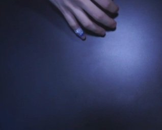 oversleep_copy's tweet photo. 먼작귀 밴드 일회용 반창고
.
.
.
늦잠님께서는 2가지중 피크닉밴드를 사용하셨습니다.
#싸이코드 #psycord #늦잠 #잠민수 https://t.co/6GKcpjn6Zk