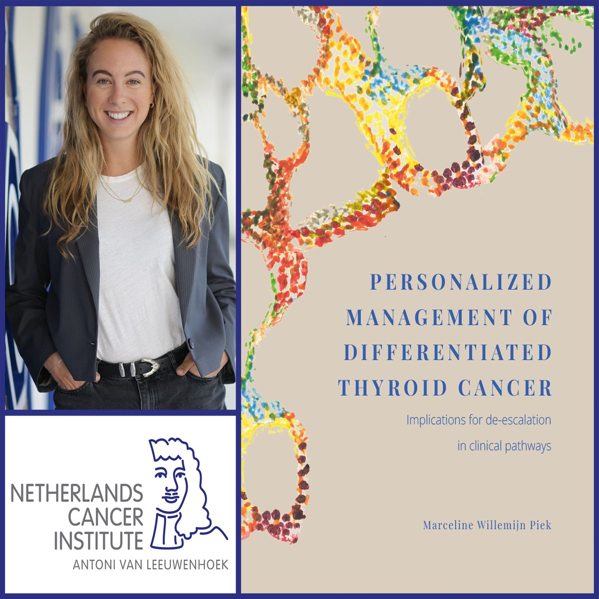 'A spot in the thyroid doesn't always require treatment. Sometimes, it's better to do nothing,' concludes PhD candidate Marceline Piek @hetAVL @NKI_nl @uniutrecht ➡️ bit.ly/3MESKYK