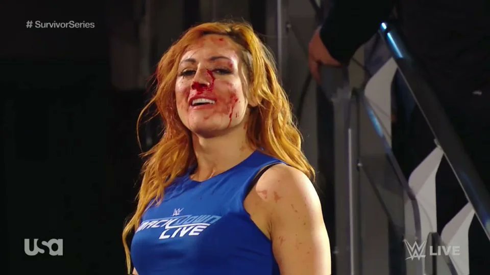 5-years ago today... Becky Lynch had her nose broken in a segment on #WWERAW. What a visual. Iconic.