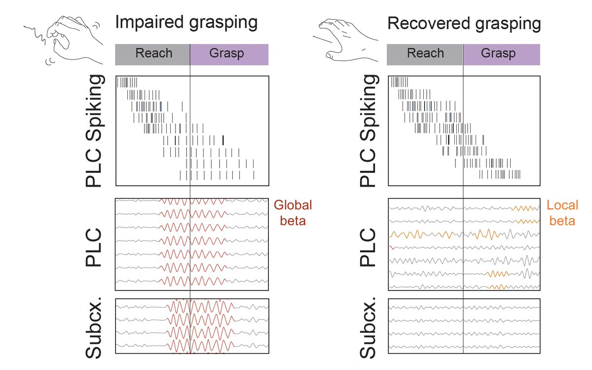 prekhanna's tweet image. I’ll be missing #SfN2023 #SfN23 this year, but do check out our poster (PSTR414.09) that Behraz Farrokhi from @KaruneshGanguly’s lab will be presenting on Tues afternoon.